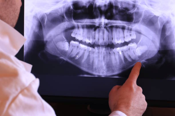 Best Emergency Dental Services for Seniors in San Jose, CA